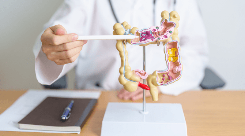 Com diagnóstico precoce, câncer colorretal tem 90% de cura