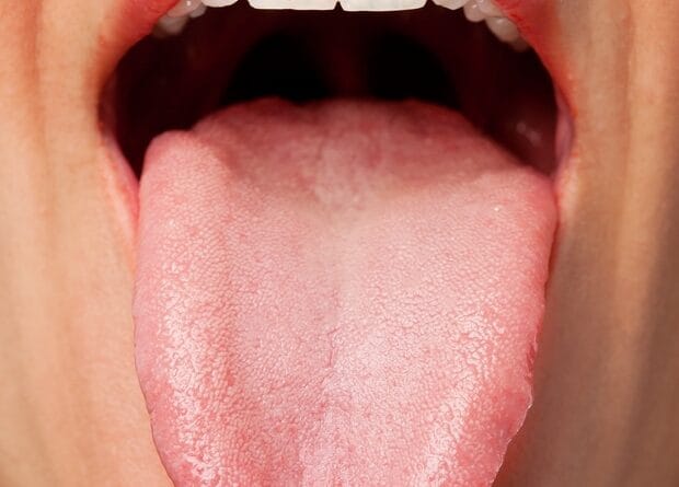 Falta de cuidados com a língua pode impactar a saúde
