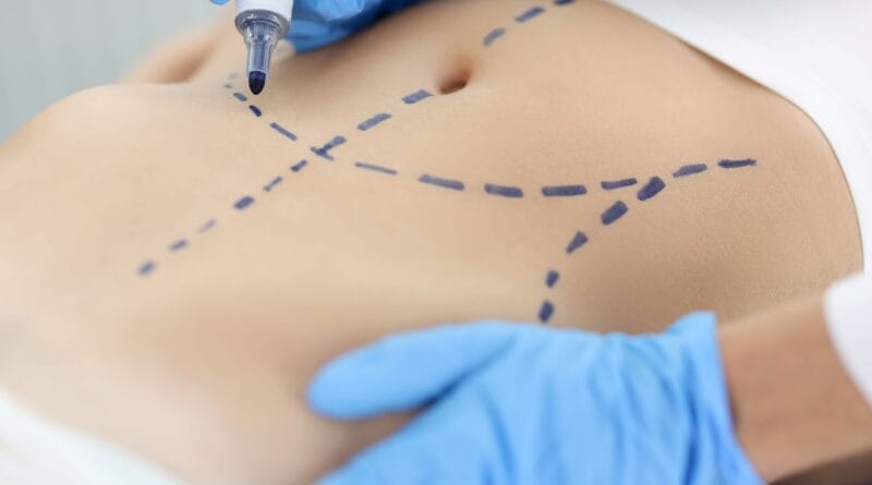 Cirurgia plástica: busca por resultados naturais é tendência