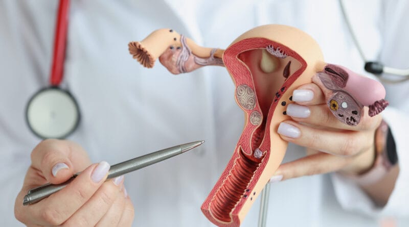 Tumores ginecológicos afetam 13% das mulheres no Brasil