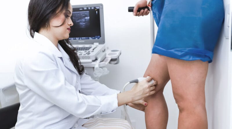 Médica explica uso do Endolaser para tratar veia safena