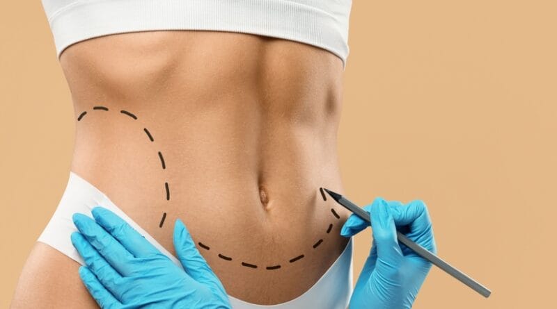 Beleza natural é foco da cirurgia plástica em 2025