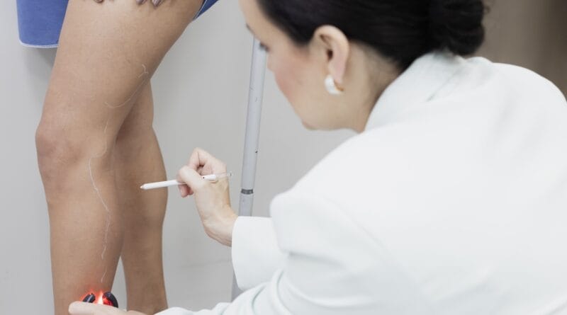 Cinco sinais que podem indicar problemas na circulação