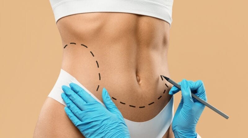 Cirurgia plástica busca naturalidade e equilíbrio