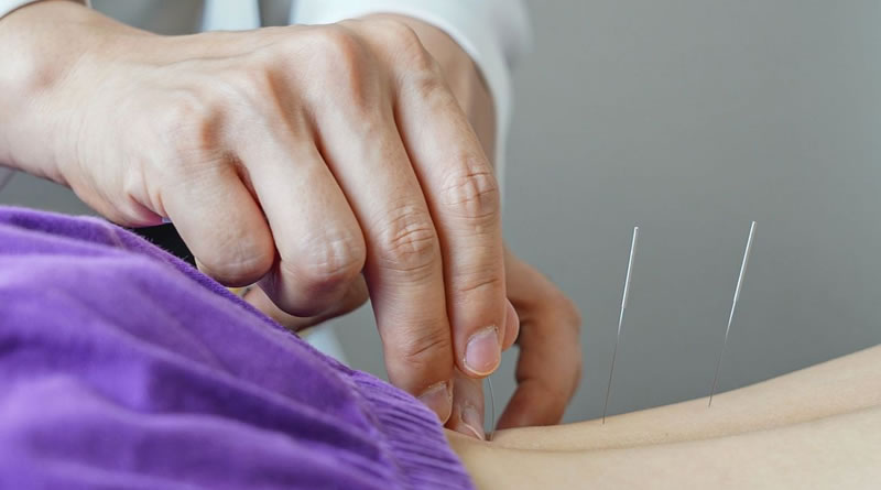 Governo do Brasil regulamenta o exercício profissional de acupuntura